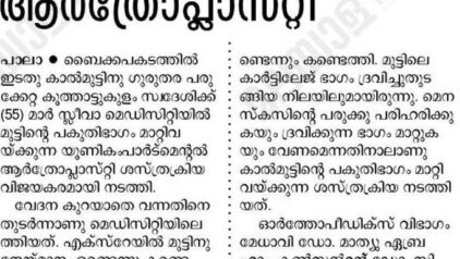 Unicompartmental Arthroplasty Successfully  Performed at Mar Sleeva Medicity Palai
