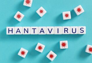Hantavirus: Symptoms, Transmission, Prevention & Treatment